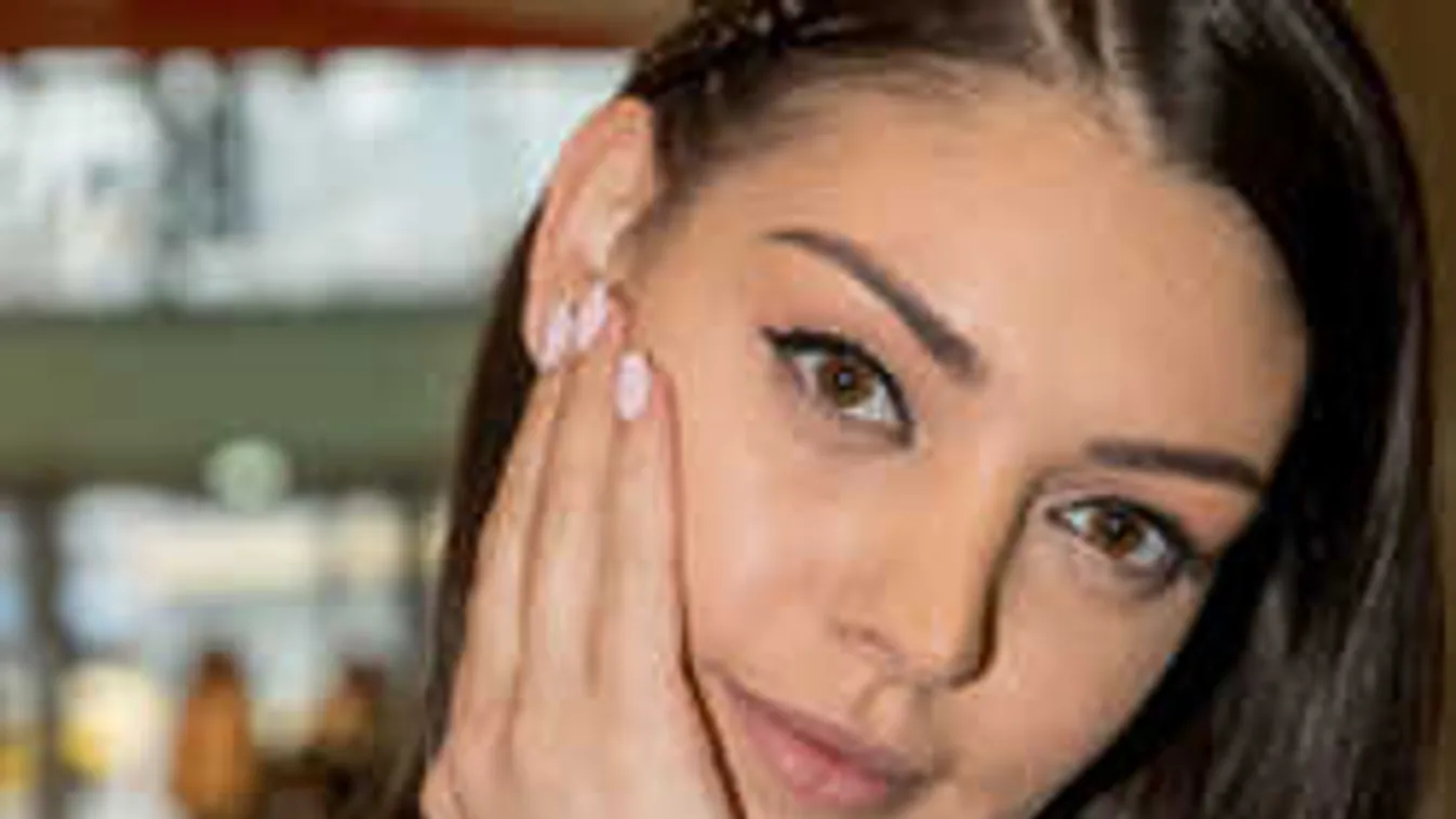 Durva fotó: Balesetet szenvedett Kulcsár Edina