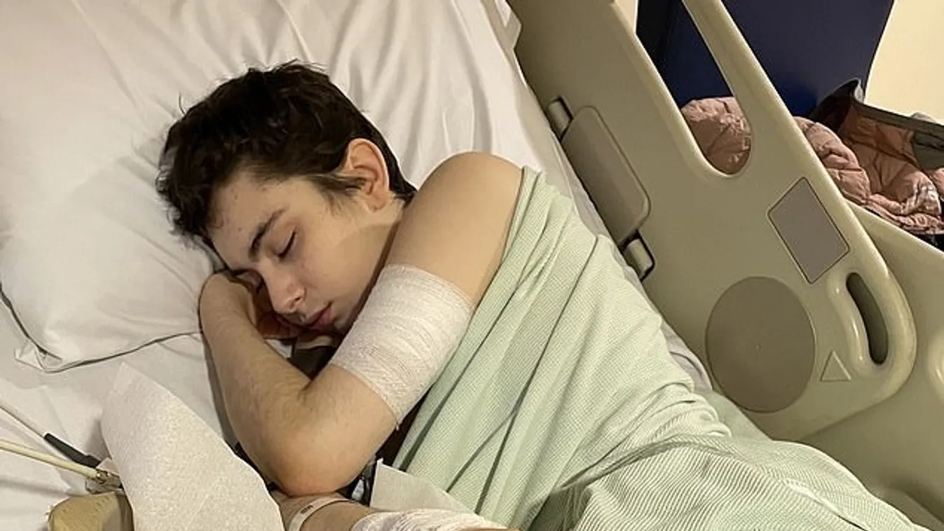 Életveszélybe került a 12 éves fiú, miután 54 mágnes került a gyomrába