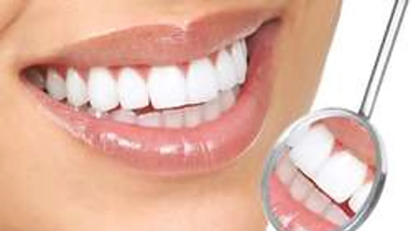 Így szabadulj meg a fogkőtől fájdalommentesen!
