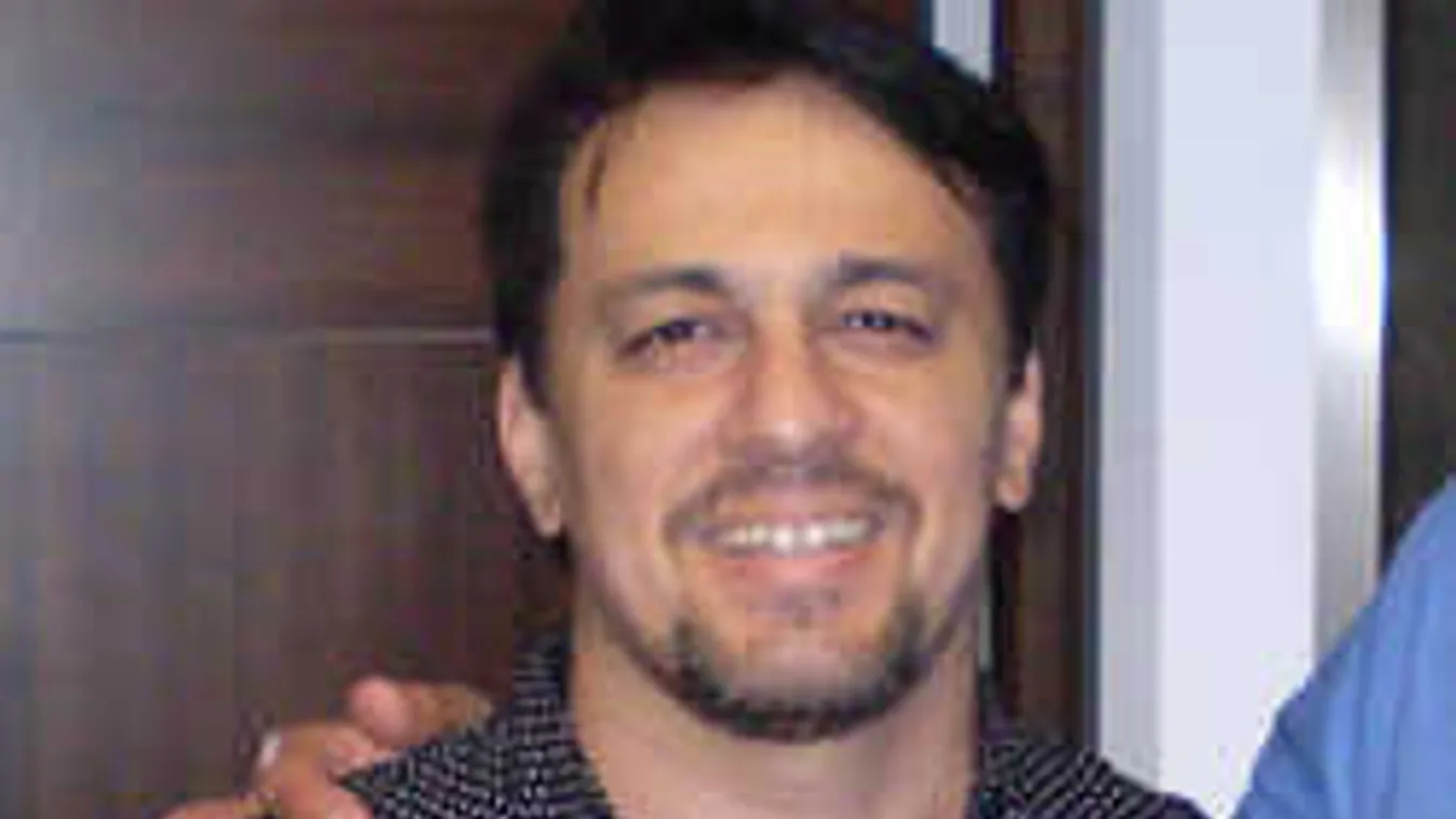 Rémisztő diagnózis, ezért hullottak ki a magyar sztárénekes fogai