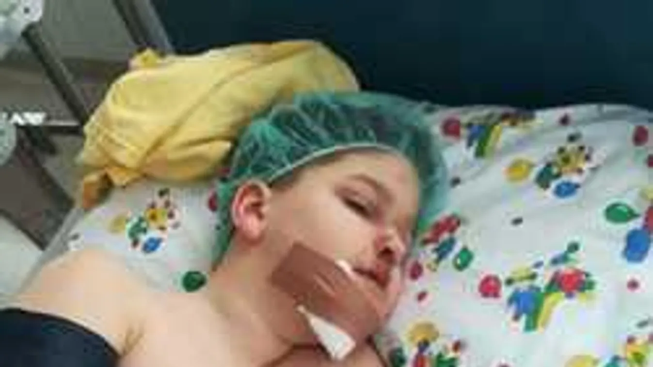 Súlyos baleset, miért nem hívott orvost a gyerekhez a tanár?