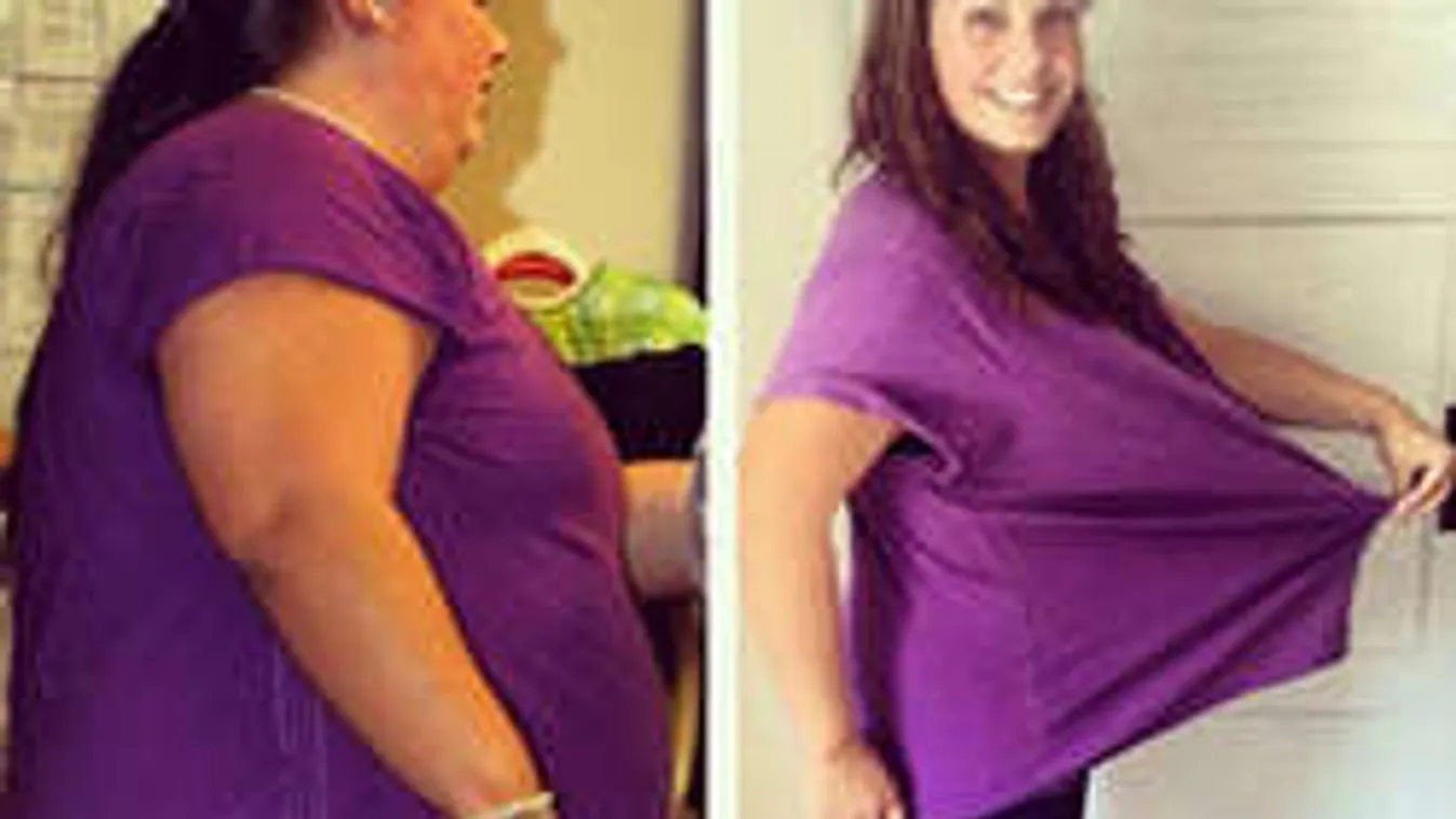 Kíméletlen őszinteséggel mutatta meg a fiatal lány, milyen 75 kilót fogyni