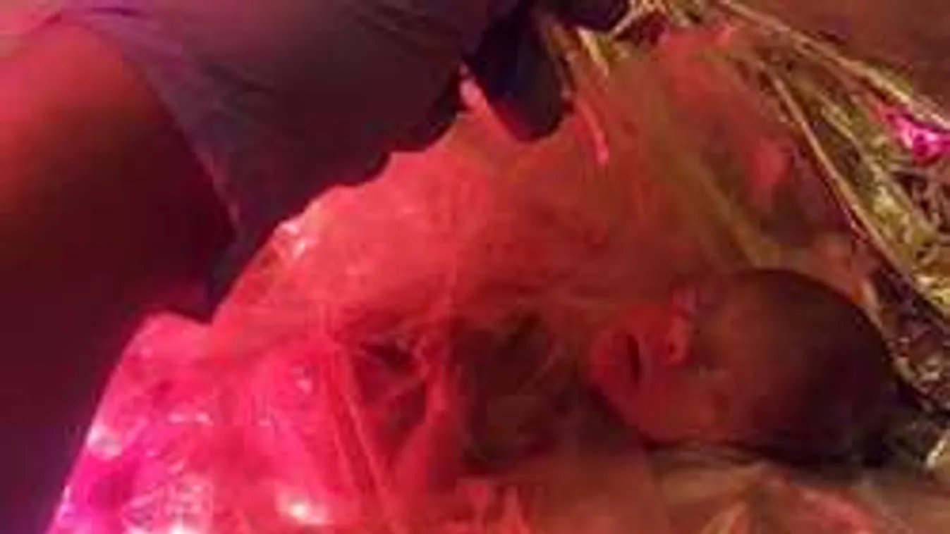 Csoda! 24 hetes magzatot élesztettek újra Budapesten!