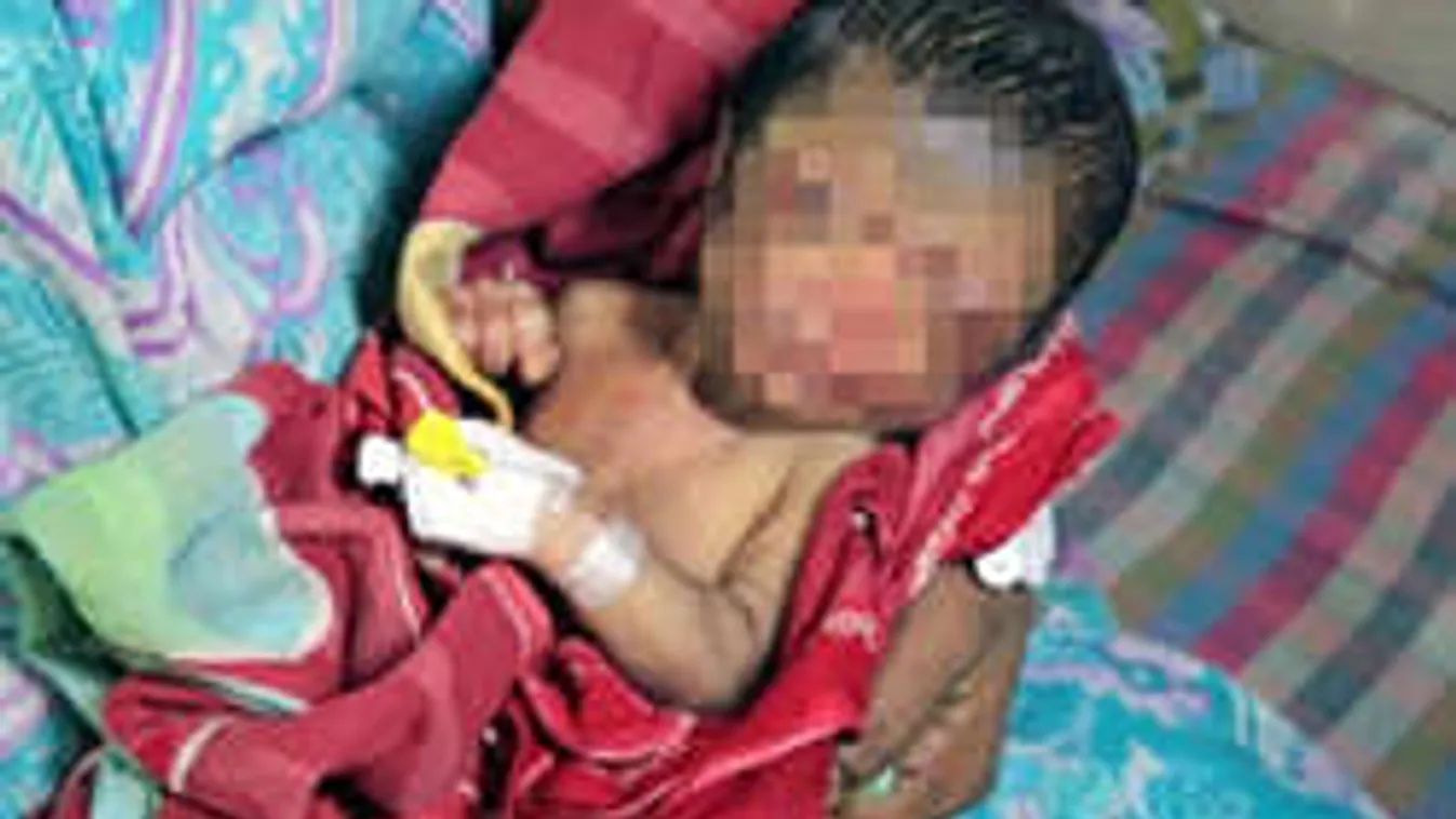 Még a szülészorvos is sokkot kapott, amikor meglátta ezt az újszülöttet!