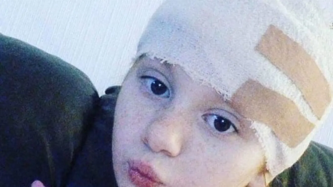 „Tűz, tűz!„ – sikoltozta fájdalmában a lángoló 4 éves kislány édesanyjának