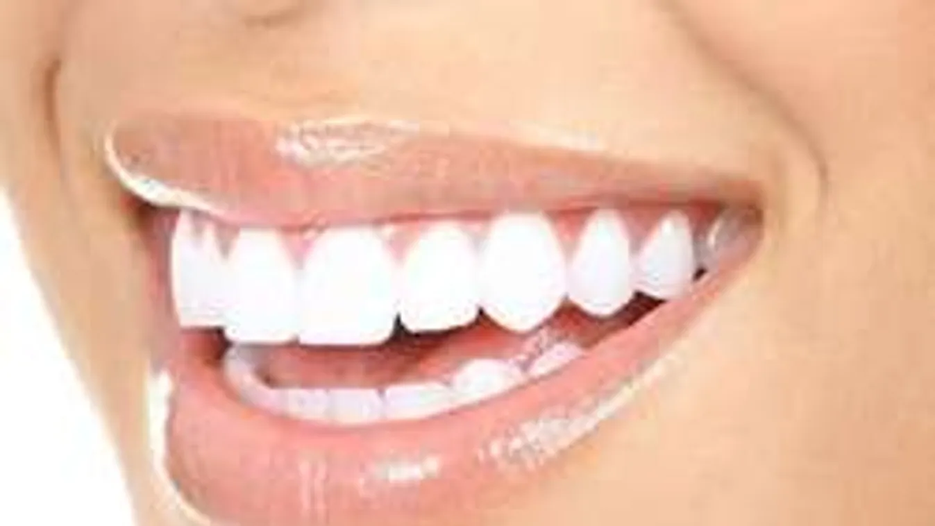 Így teszed tönkre a fogaidat anélkül, hogy tudnál róla