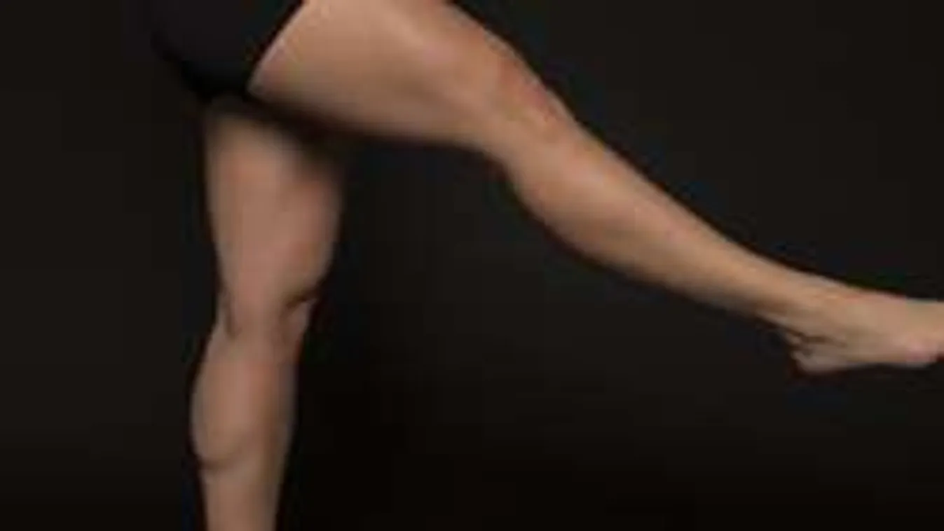 Bátor lányok megmutatták: ilyen a valódi nők meztelen combja