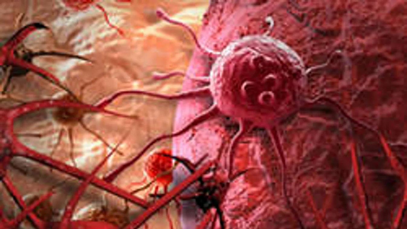 Egy tartósítószer, ami megöli a rákos sejteket! Ez lehet az ellenszer!