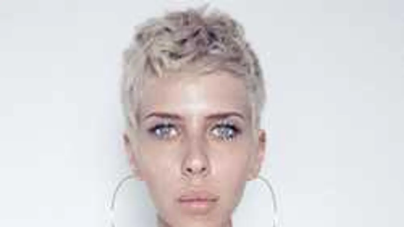 Aggódnak a rajongók: Sokkoló fotót posztolt a magyar sztár