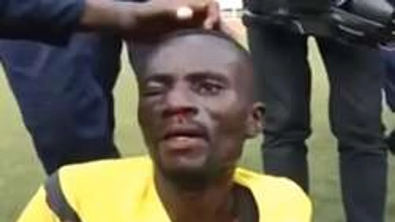 Szurkolói terror, hordágyon a partjelző