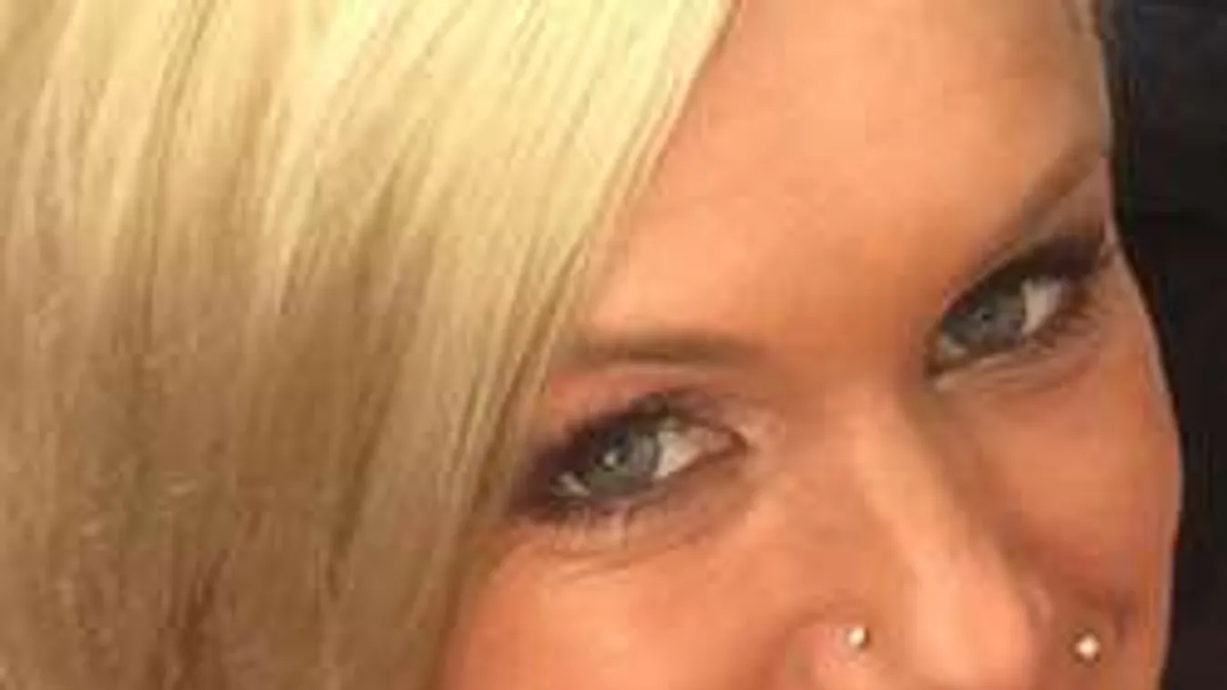 Molnár Anikó gigamellei kitakarják a napot