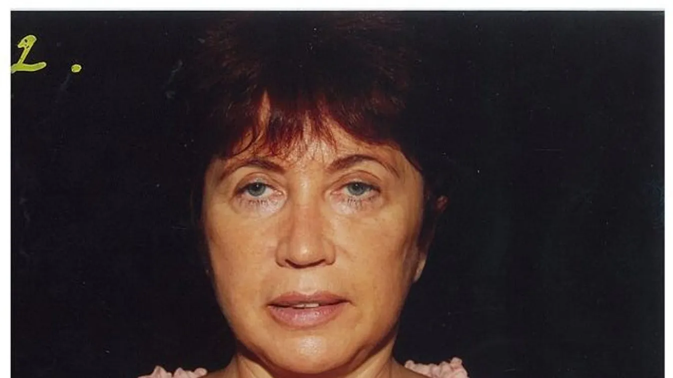 Milliós műhibaper: menekül a sebész, nem akar fizetni