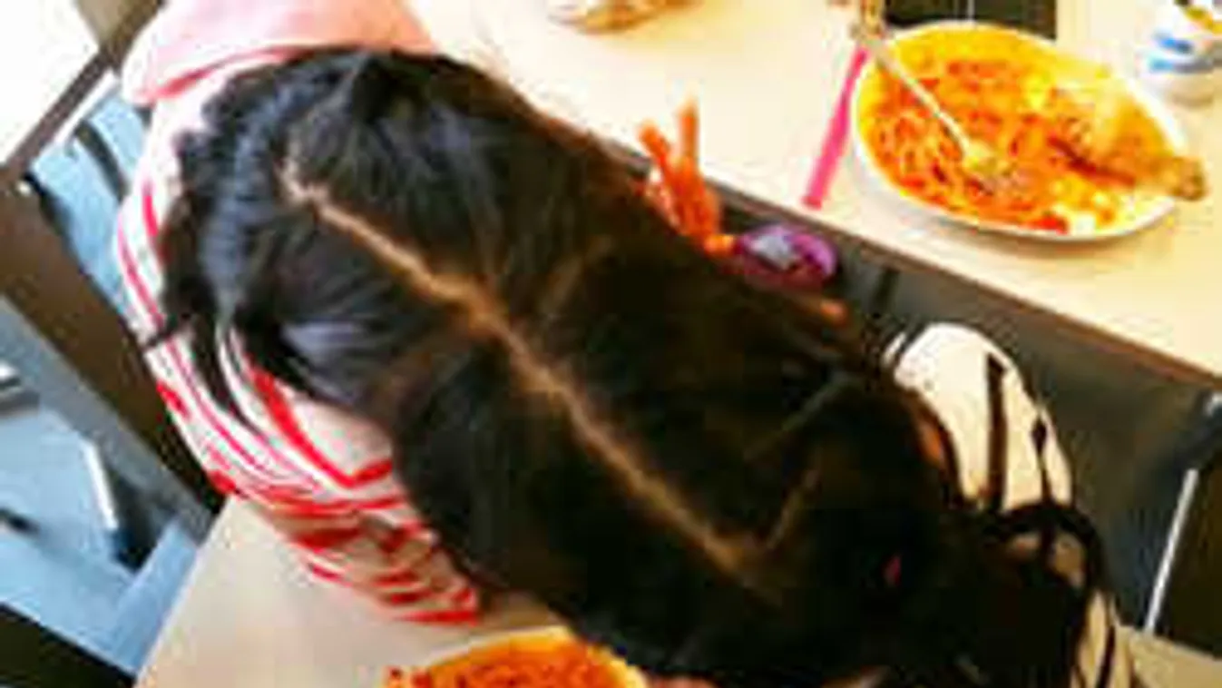 Külön utakon folytatnák a fejüknél összenőtt sziámi ikrek - fotókkal