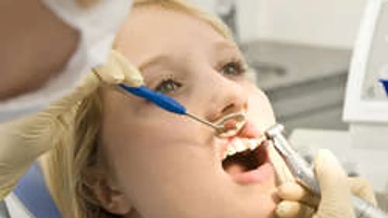 Hihetetlen, hogy mit nyelt le a fogorvosnál