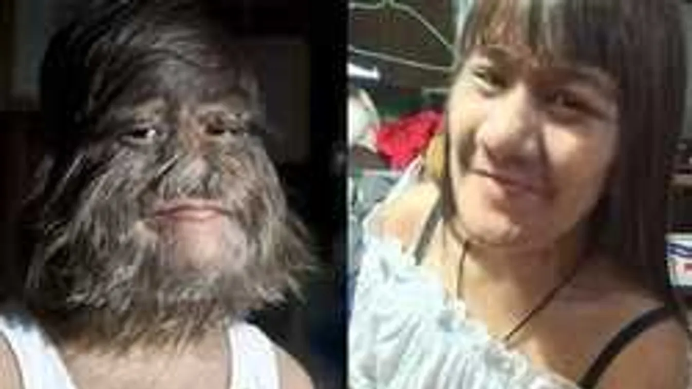 Vérfarkas: Megházasodott a világ legszőrösebb nője!