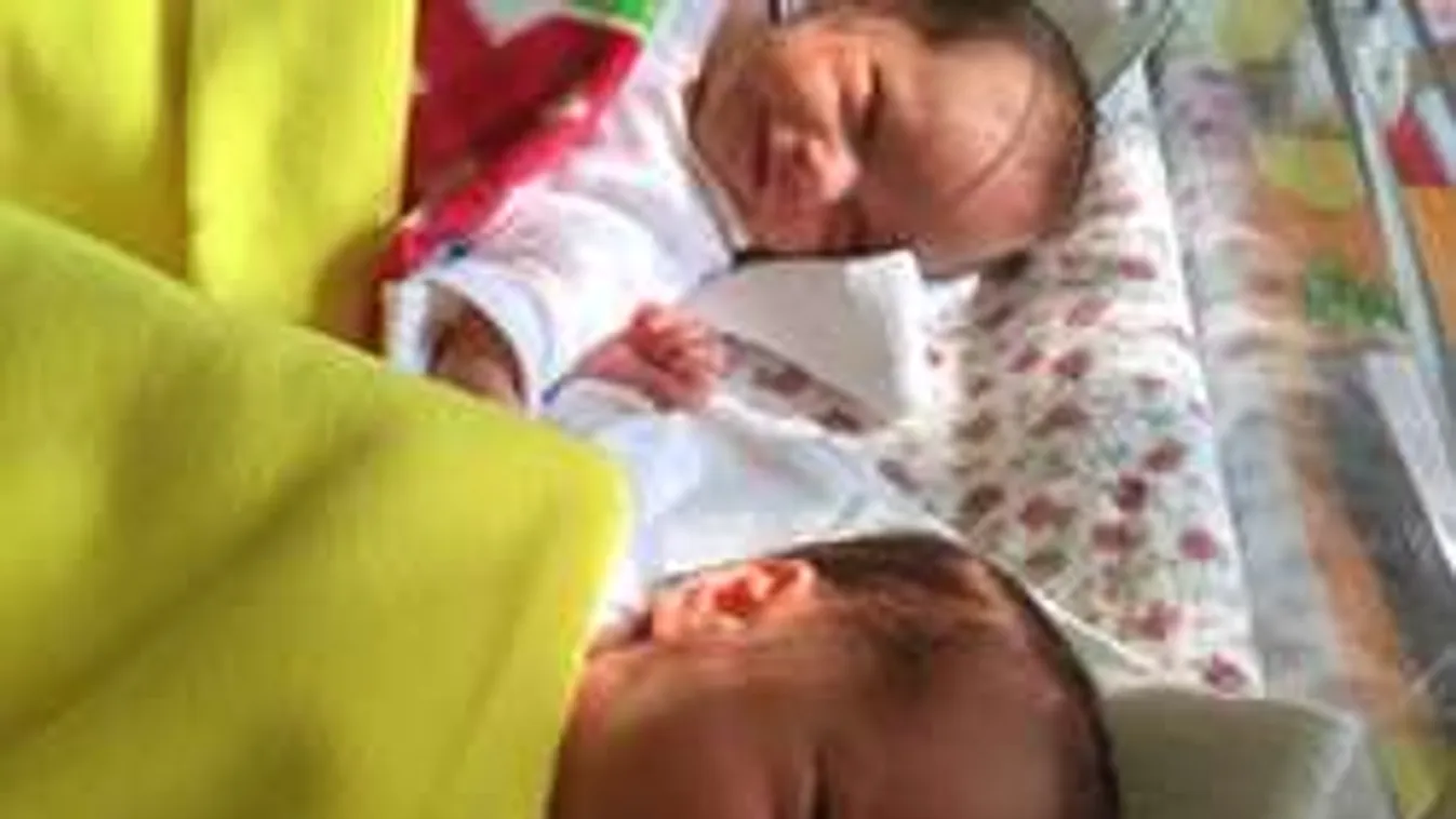 Édesanyjuk méhében operálták meg Sárát és Lilit