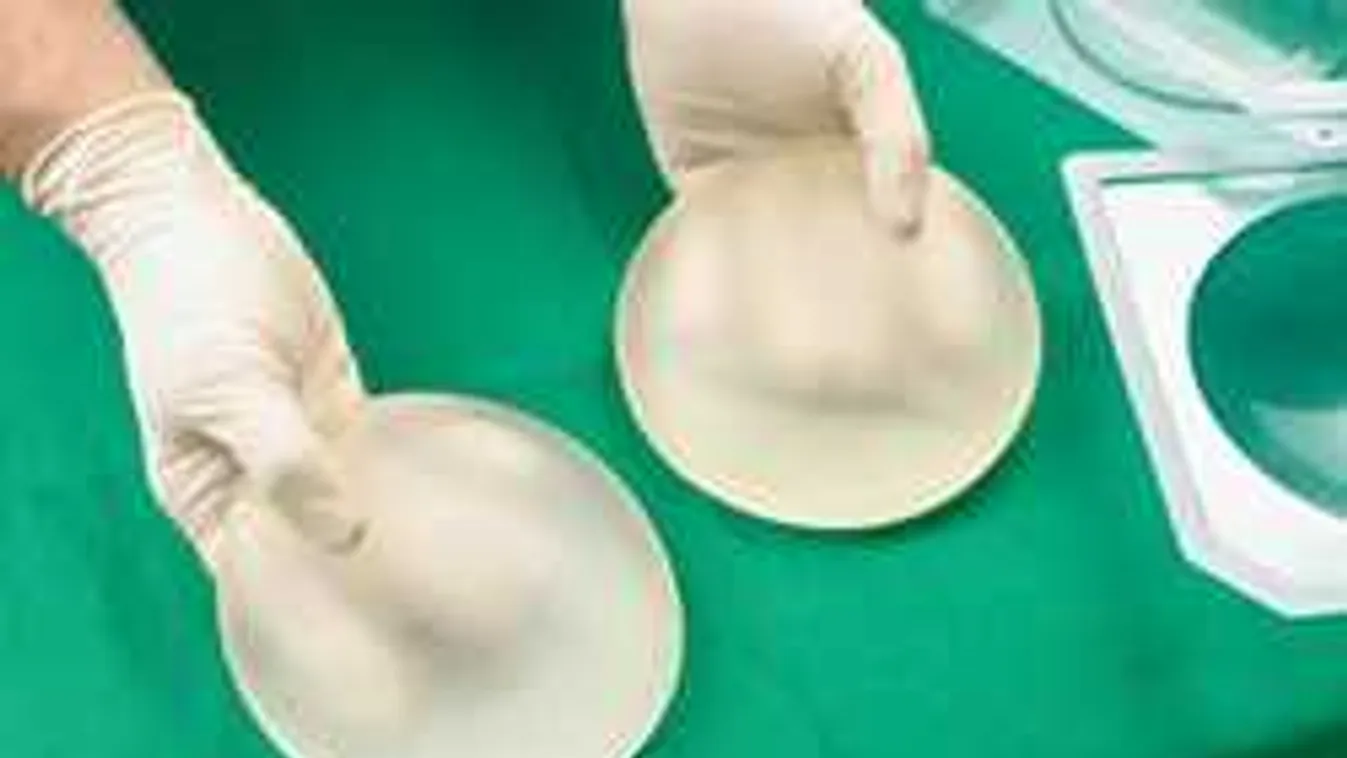 Õ a legnagyobb szilikonmellű magyar nő!