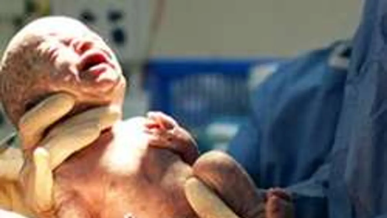 Ezekkel a sérülésekkel születnek a drogos babák! Megéri?