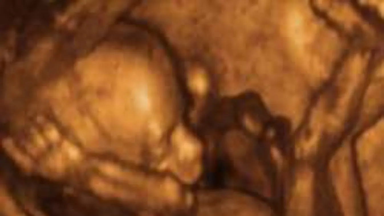 Rejtélyes vérfürdő: még a terhes nőnek se kegyelmeztek