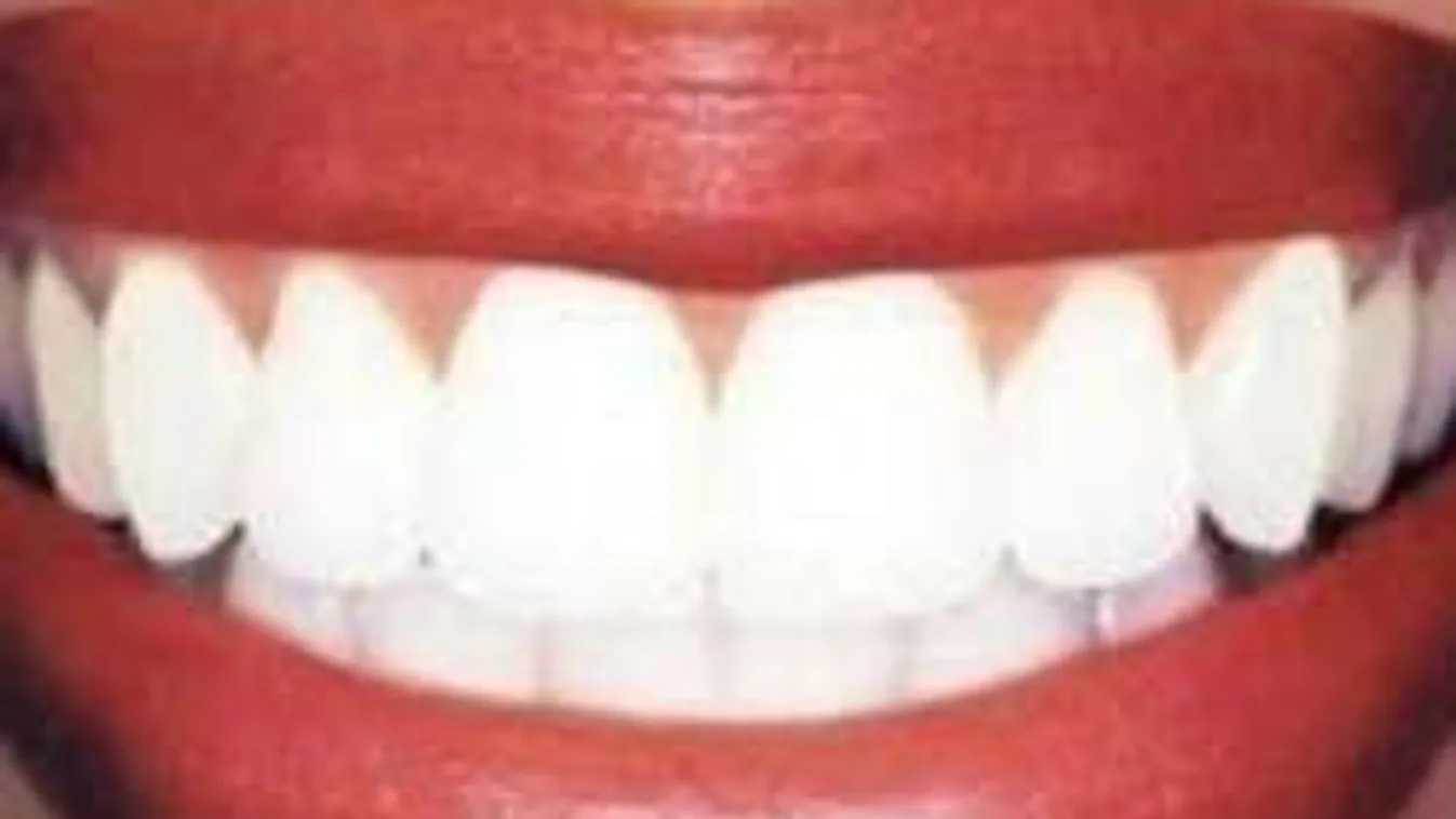 Fogat mosol evés után? Soha többé ne tedd!