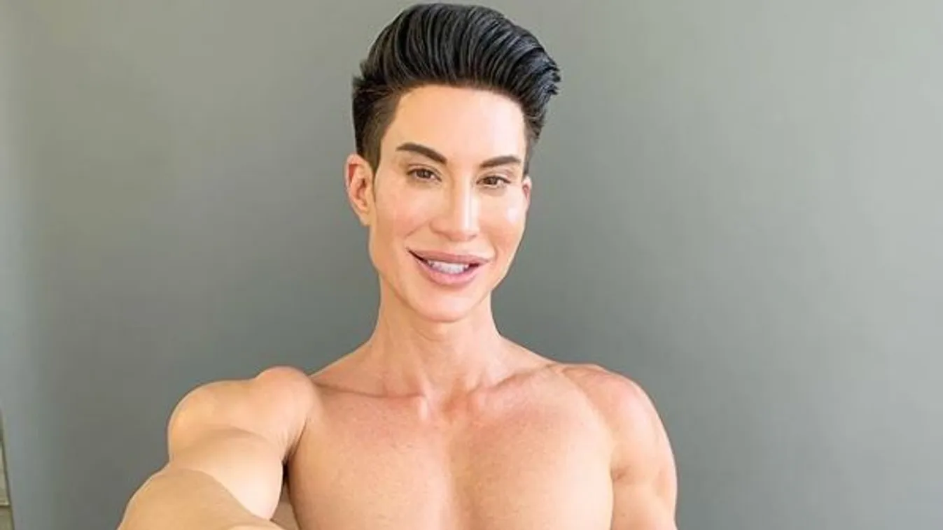 Megáll az ész: bizarr kezeléseknek vetette alá péniszét az élő Ken baba