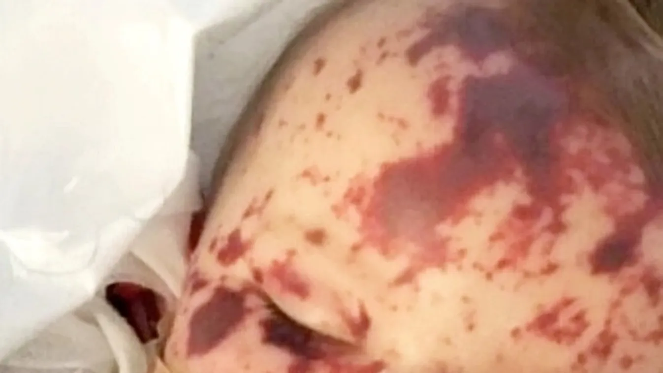 „Nem fogja túlélni” – közölték az orvosok a kislány anyukájával