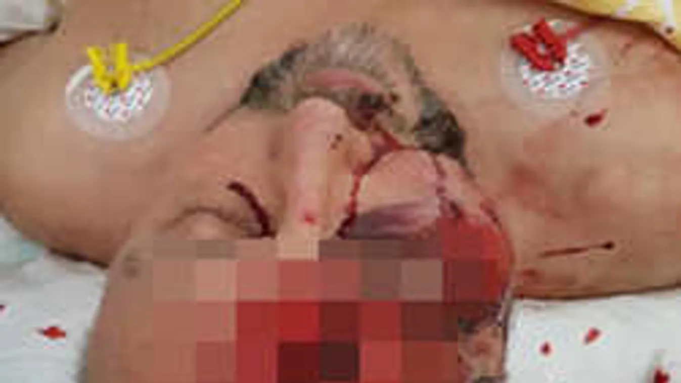 Bevándorlás-ellenes politikája miatt verhették félholtra a képviselőt