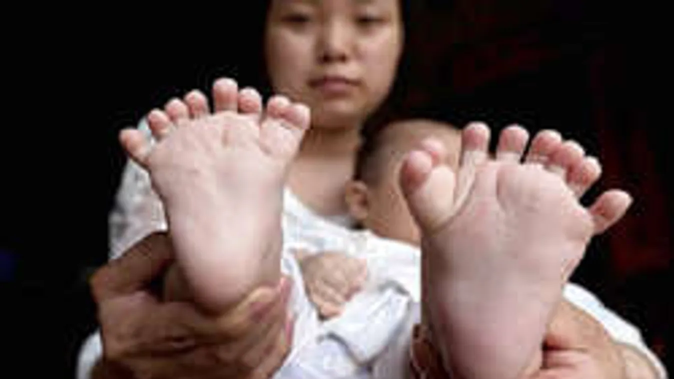 Sokkot kaptak a szülők, mikor gyermekük 31 ujjal született