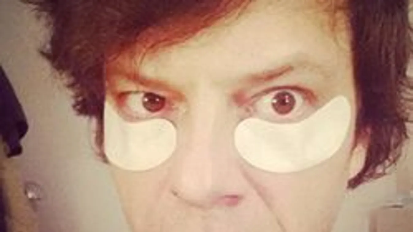 Háromhavonta plasztikáztatja magát Tilla