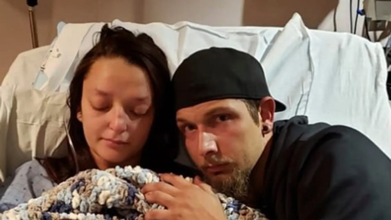 Szívszaggató fotók: Szörnyű, mi történt a cukorbeteg kismama babájával