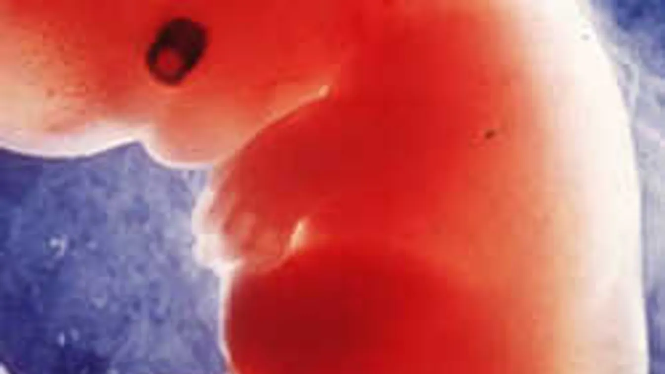 Van rá módszer, hogy ne öljenek embriót a lombikbébiprogramban