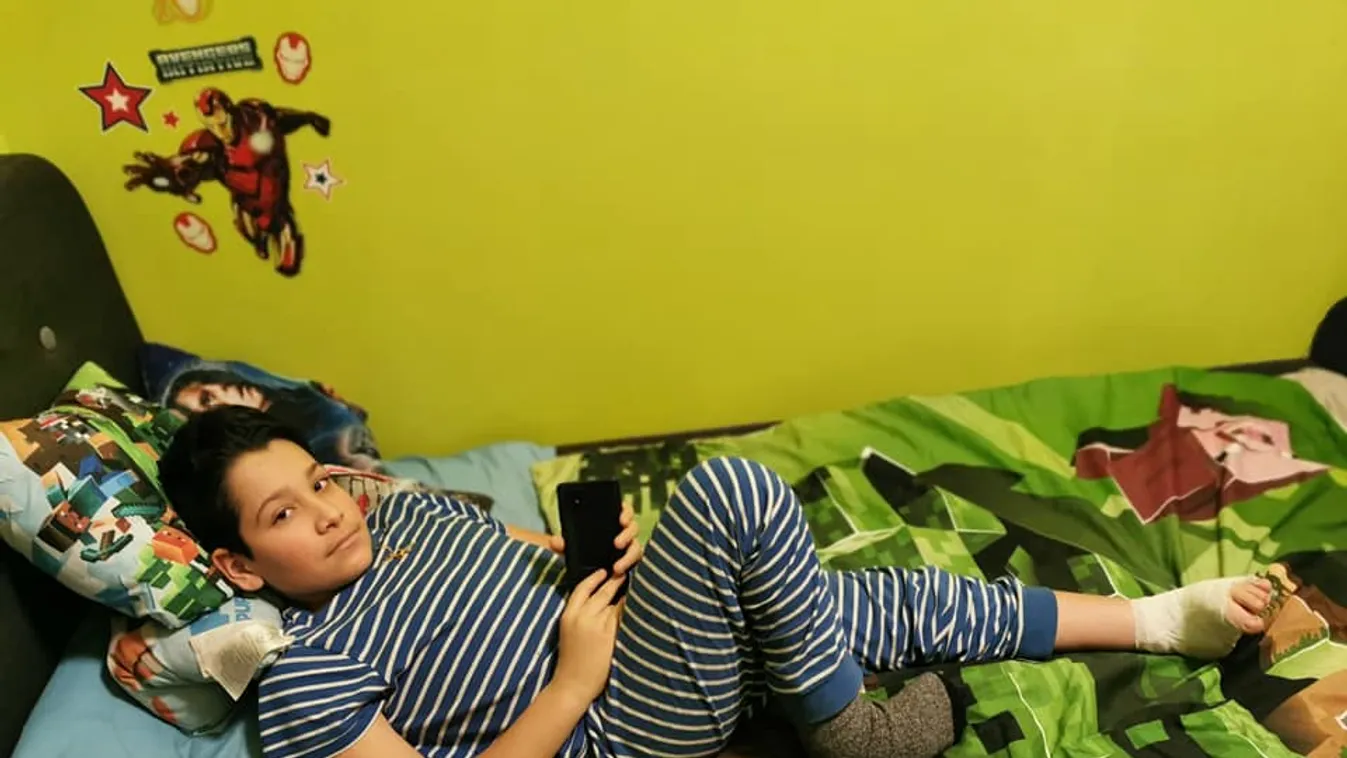 Elveszítheti végtagjait a dongalábú kisfiú