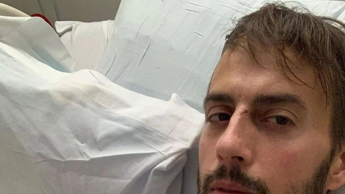 Javul Lady Gaga asszisztensének állapota