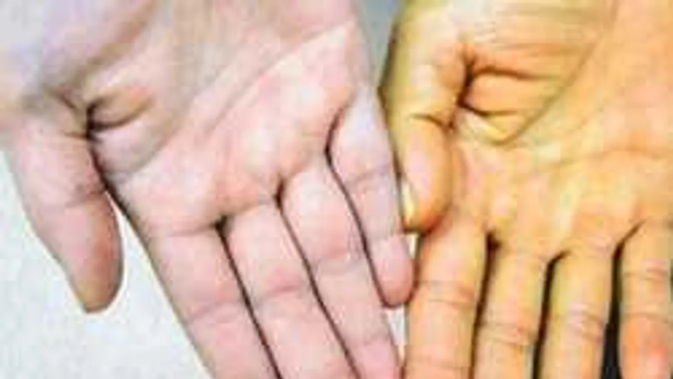 Vigyázz, ez a 6 jel azt mutatja, hogy gond lehet a májaddal