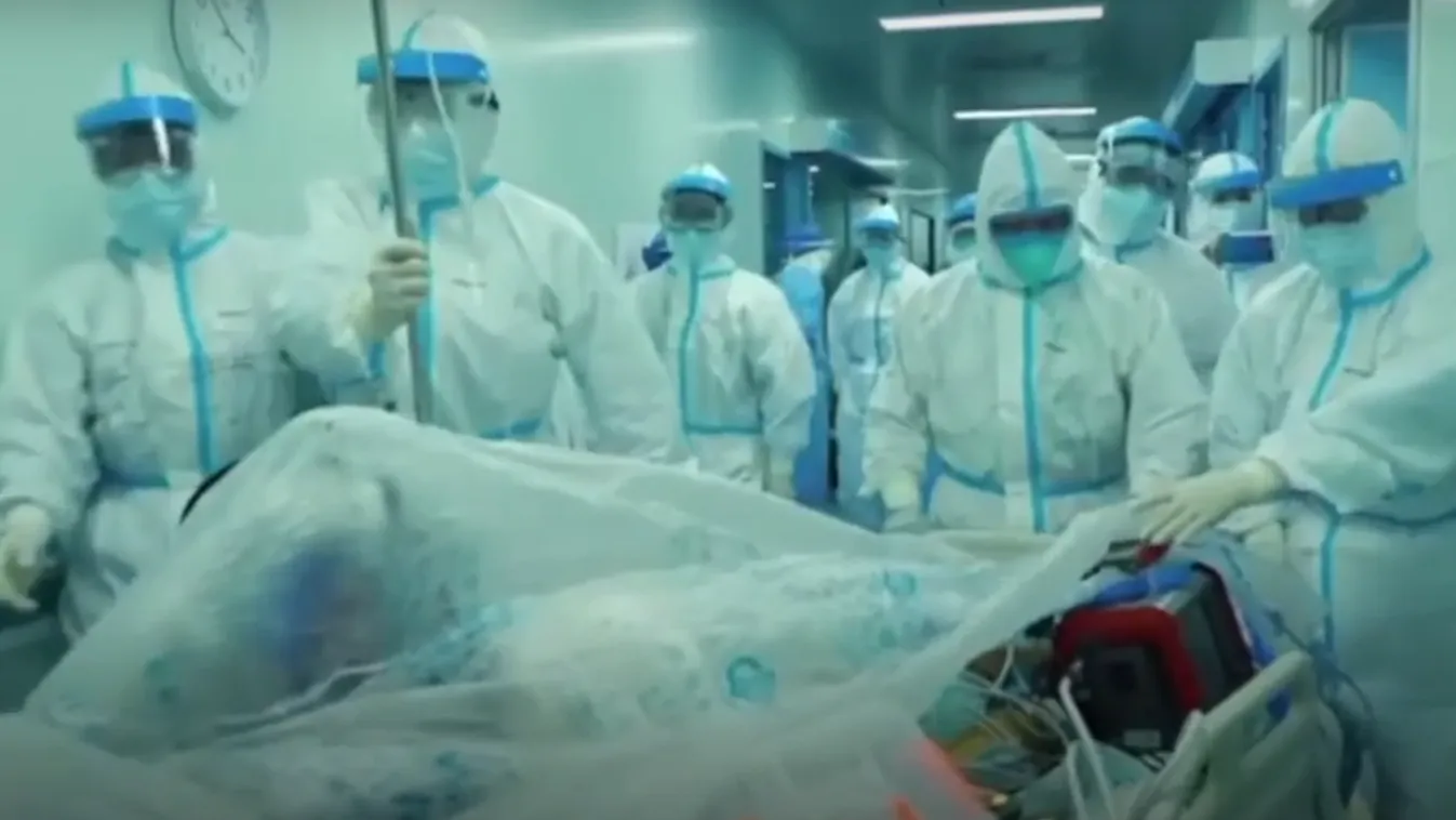 Tüdőátültetéssel mentették meg a koronavírusos 65 éves férfi életét