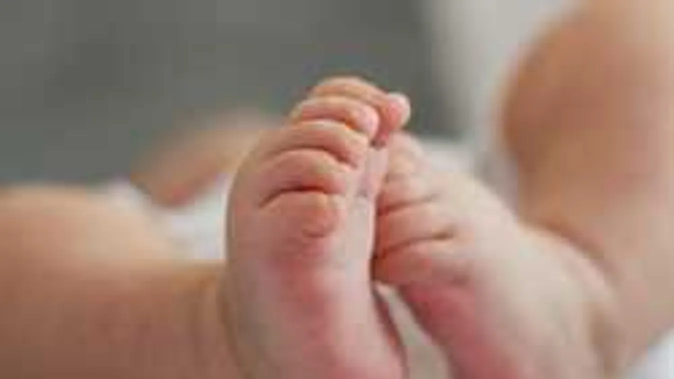 Orvosi csoda: Elképesztő műtéttel választották szét a sziámi ikreket