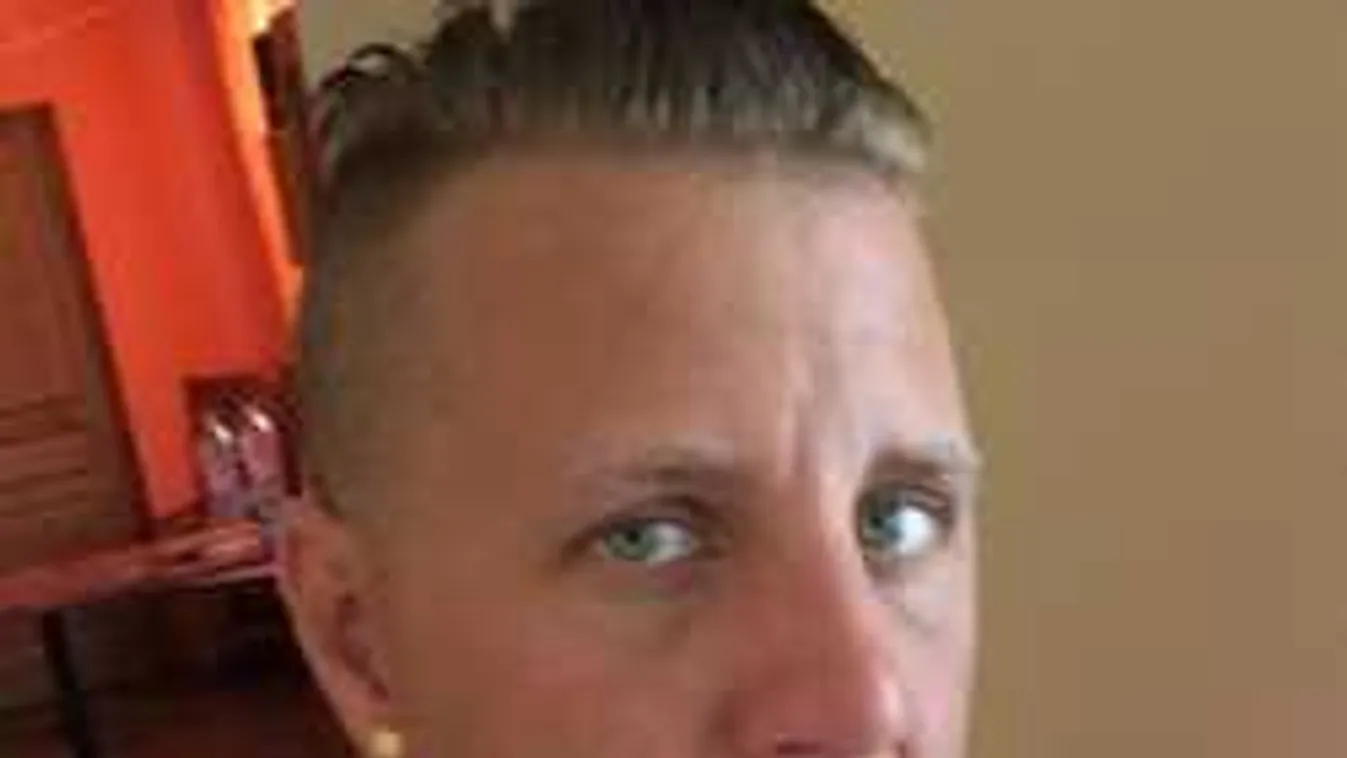 Összetörte magát Zámbó Jimmy fia, brutális képet mutatott