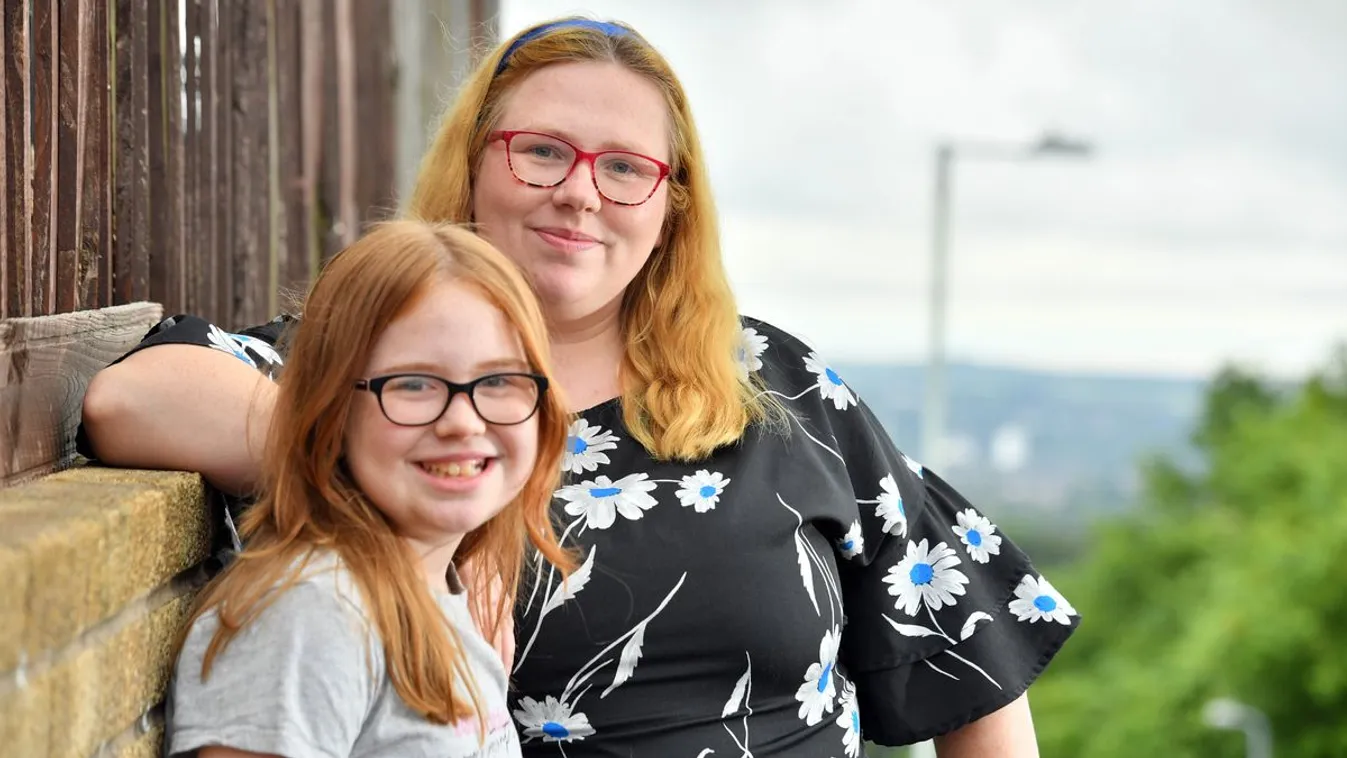 Egy 8 éves kislányt olyan ritka betegség kínoz, hogy nem tudja kinyitni a száját