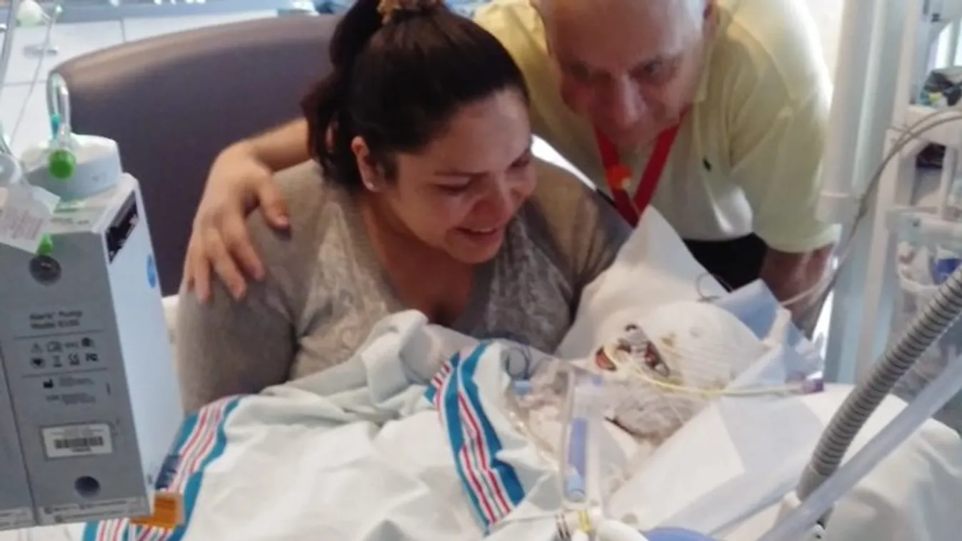 Sokkoló: súlyosan megégett egy csecsemő a lakástűzben, szinte megolvadt az arca – fotó