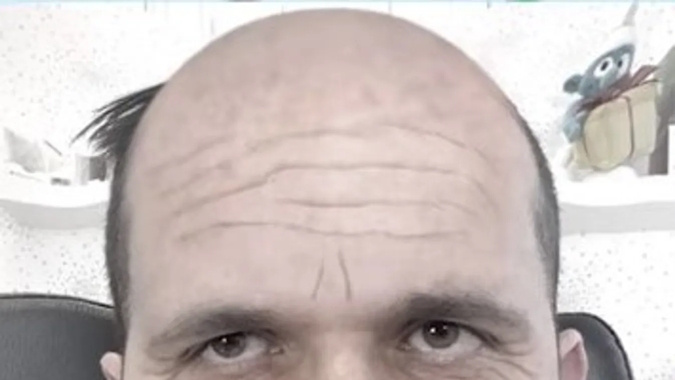 Éveket öregedett a védőoltás után a magyar orvos