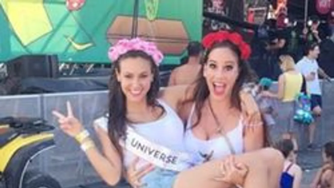 Titokzatos sérülés Vajna Tímea testén - Fotó