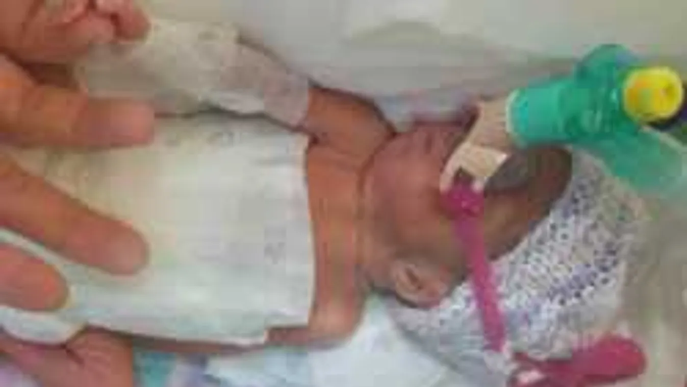 Énekkel fejlesztik a koraszülött babákat