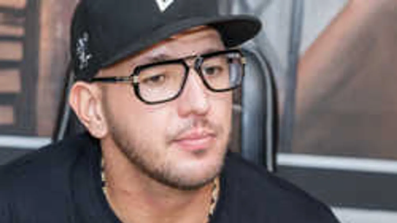 Itt az első fotó: így néz ki balesete után Curtis arca