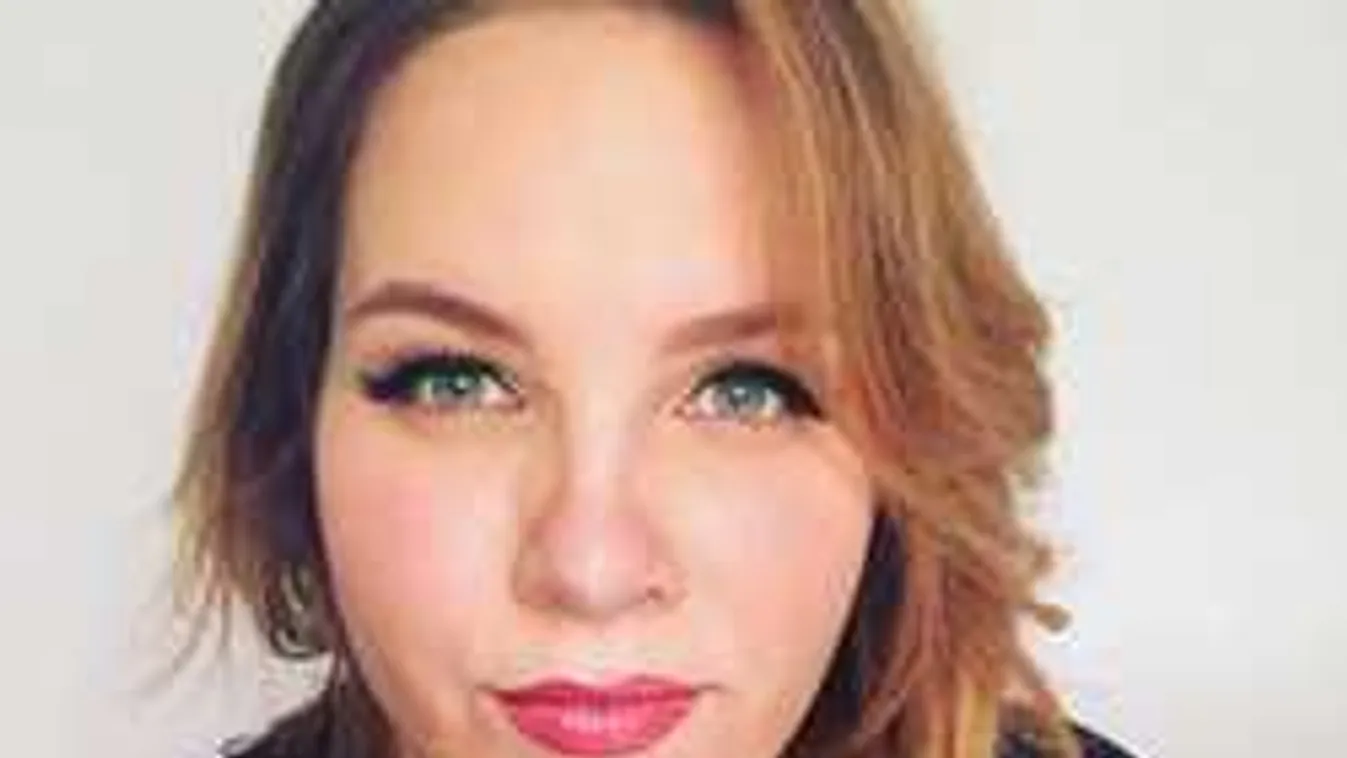 Csúnya bőrbetegség: Tóth Vera nagyon aggódik