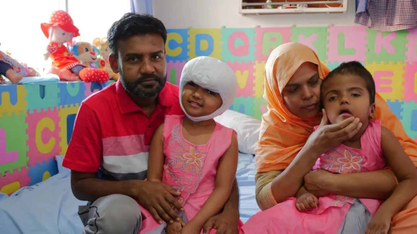 Bangladesi sziámi ikrek: sürgősen meg kell műteniük a magyar orvosoknak Rabeját