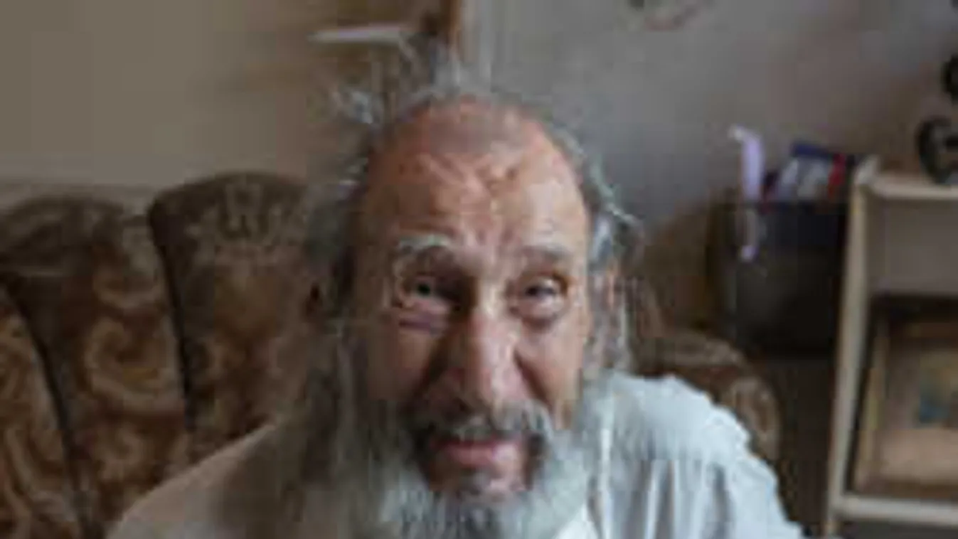 Látászavarban szenved a népszerű magyar színész