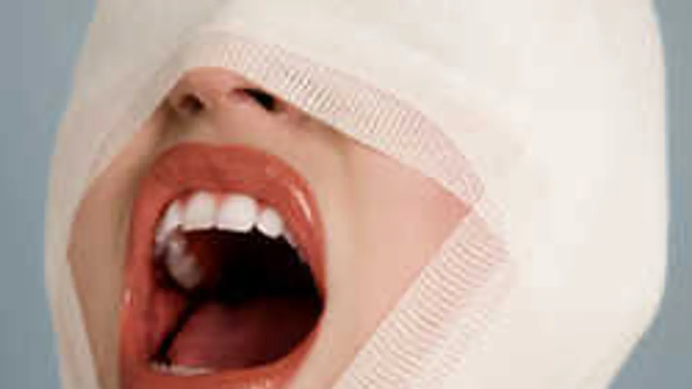 Durván félresikerült a plasztikai műtét: eltorzult arccal ébredt