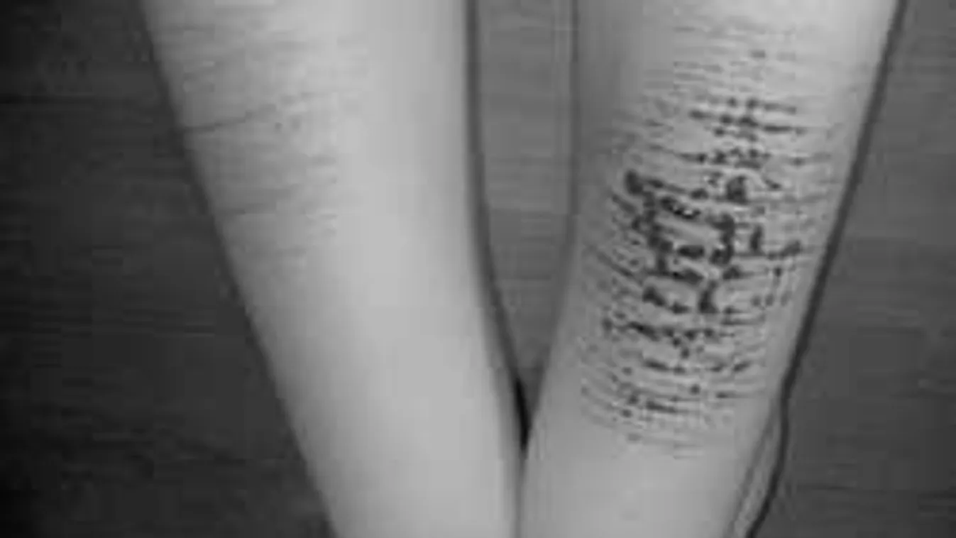 Egy magyar tinilány megdöbbentő vallomása: "egy évig vágtam magam, függő lettem"