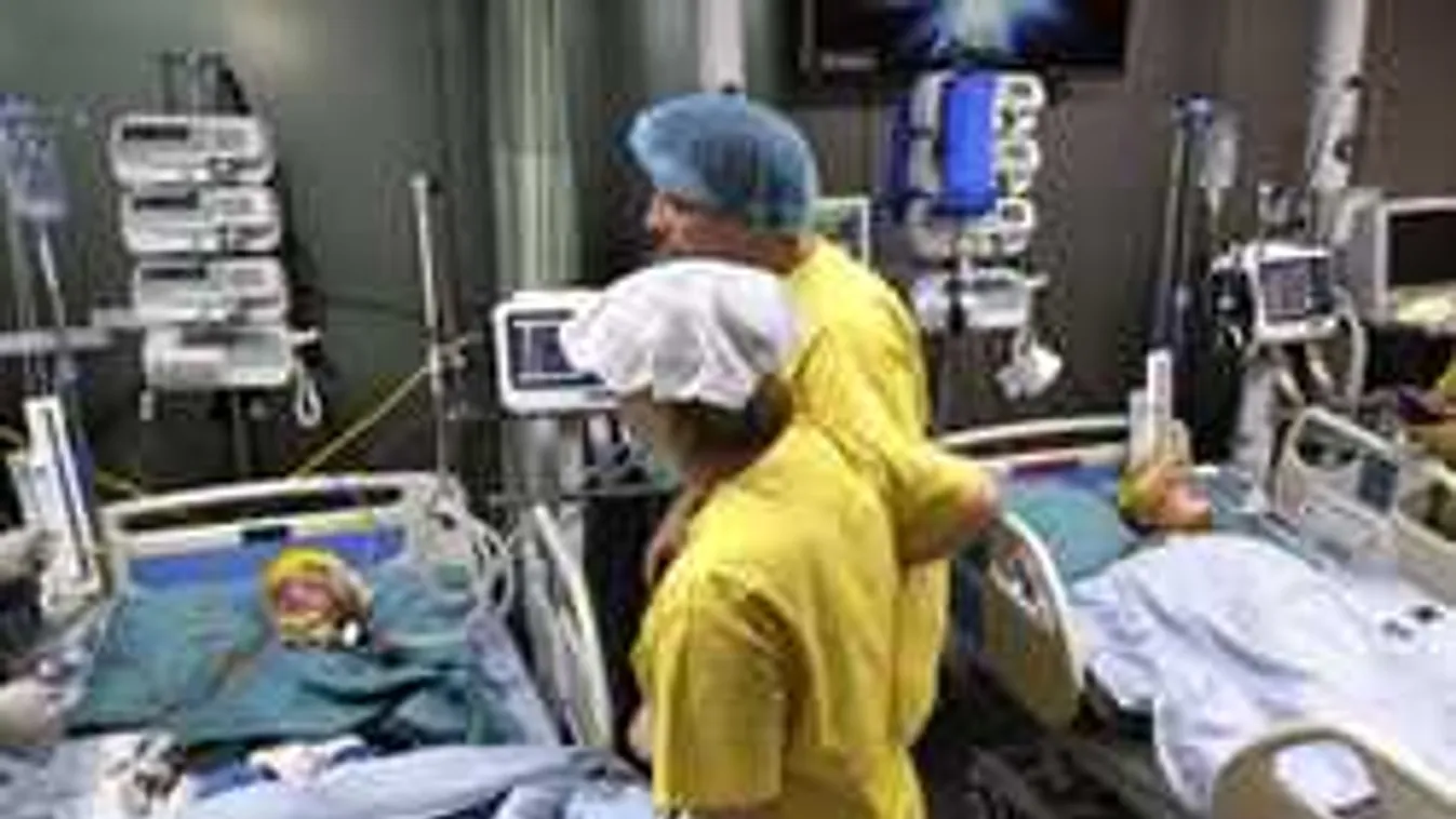 Ezt mondták a szétválasztott sziámi ikrek szülei