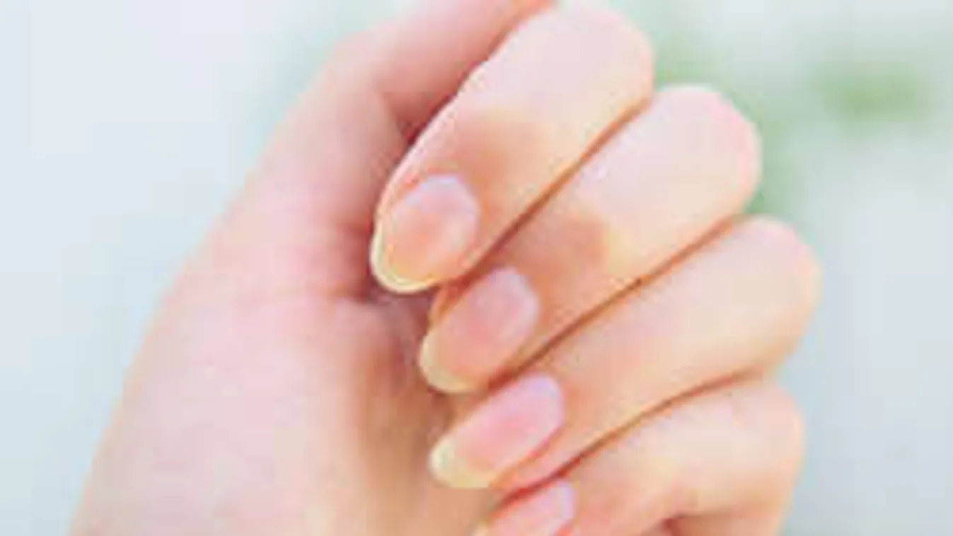 Intő jelek! Ezt árulja el a körmöd az egészségedről